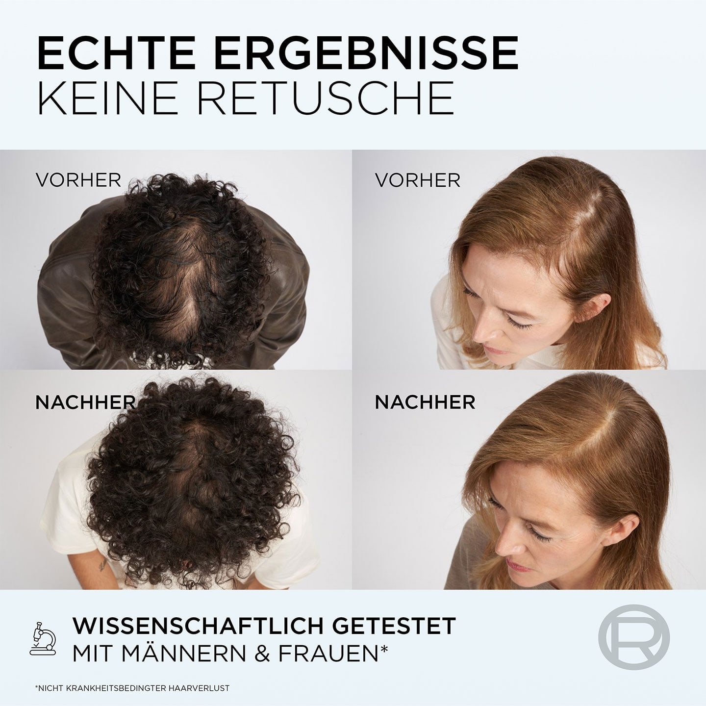 4 Detailansichten von Haaren von Männer & Frauen, darüber Text: Echte Ergebnisse keine Retusche